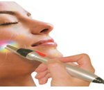 MicroLightBeauty Acupuncture non-needle Face Lift